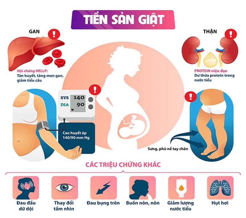 Một số dấu hiệu của tiền sản giật