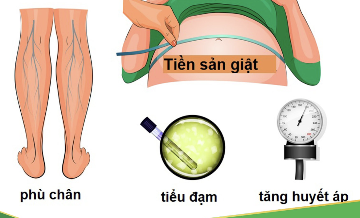 Triệu chứng tiền sản giật