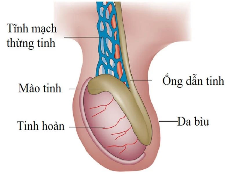                Giãn tĩnh mạch bìu là một trong những nguyên nhân gây tinh trùng loãng