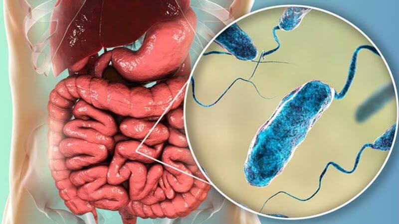 Vi khuẩn Vibrio cholerae là nguyên nhân gây ra bệnh tả