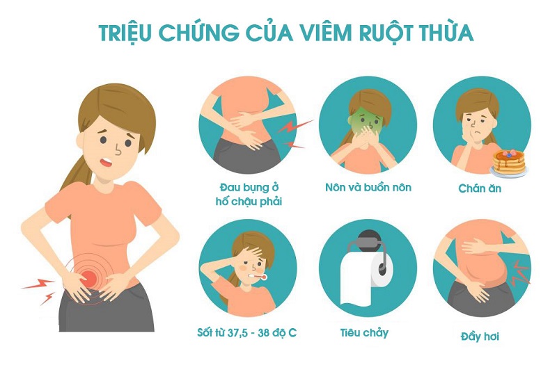 3. Các phương pháp chẩn đoán viêm ruột thừa cấp