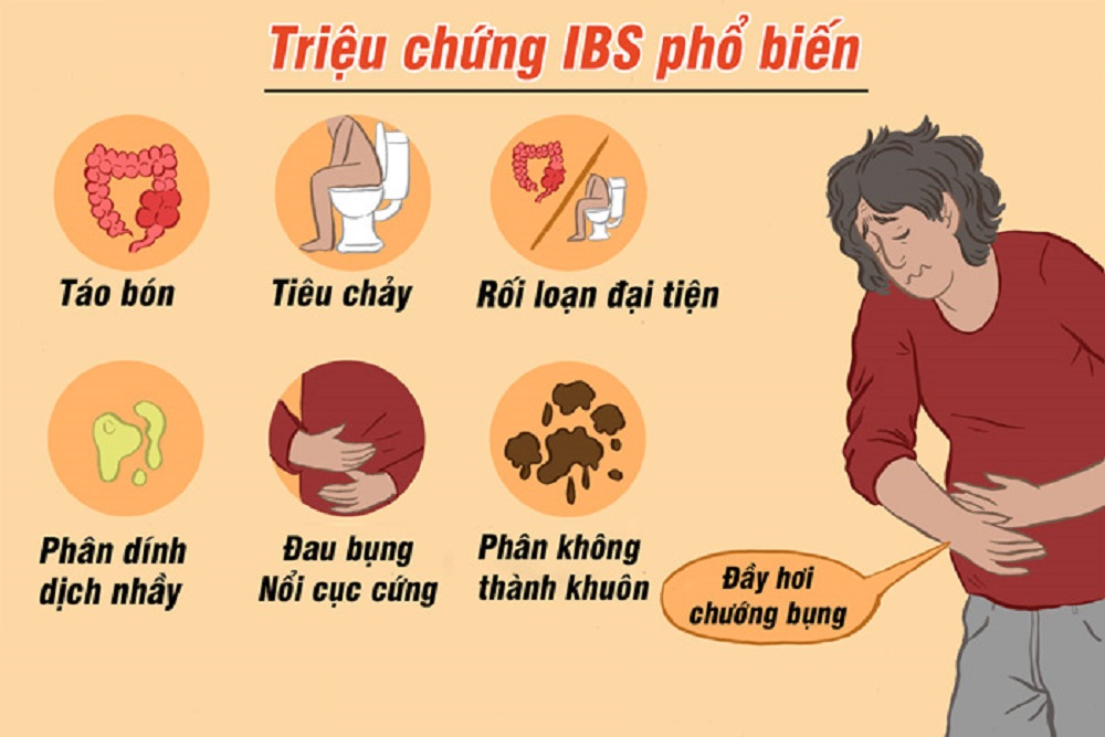 Các triệu chứng IBS phổ biến