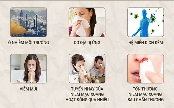 Nhiều nguyên nhân gây viêm mũi mà chúng ta cần biết