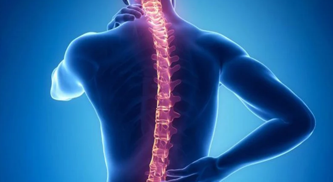 Đau lưng hoặc đau cổ có thể là triệu chứng của u màng ống nội tủy