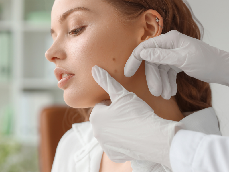 Điều trị u mềm treo là một thủ thuật thẩm mỹ đơn giản