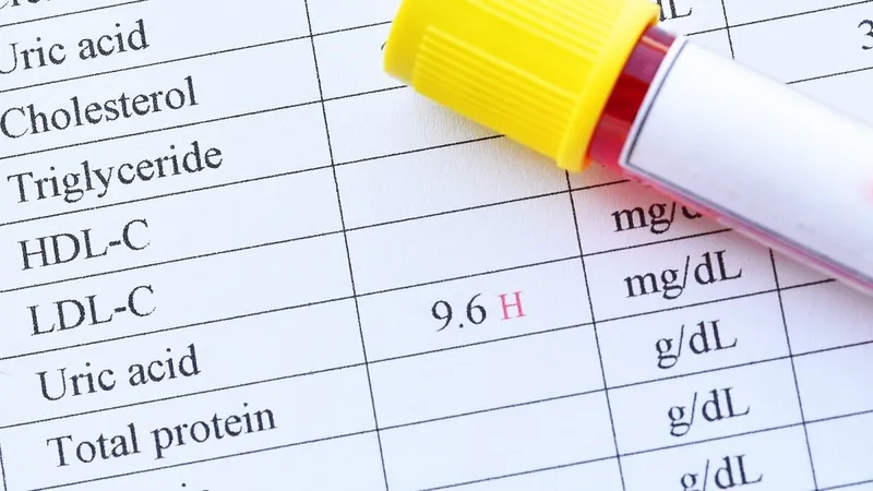 Hình ảnh minh họa xét nghiệm máu để đo nồng độ acid uric. 