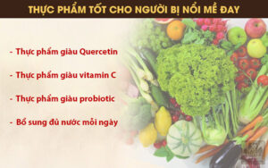 nổi mề đay nên ăn gì?