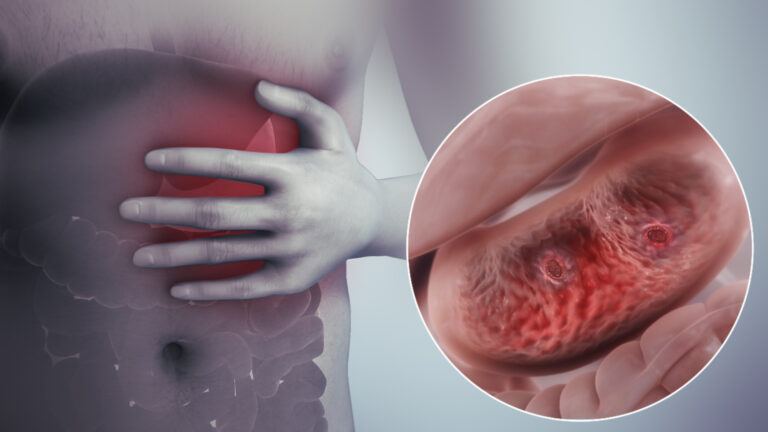 Cơn đau dạ dày kéo dài gây ảnh hưởng nghiêm trọng đến khả năng hấp thụ dinh dưỡng của người bệnh