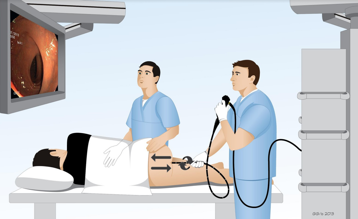 Nội soi là tiêu chuẩn vàng để chẩn đoán chính xác vị trí và mức độ của khối u