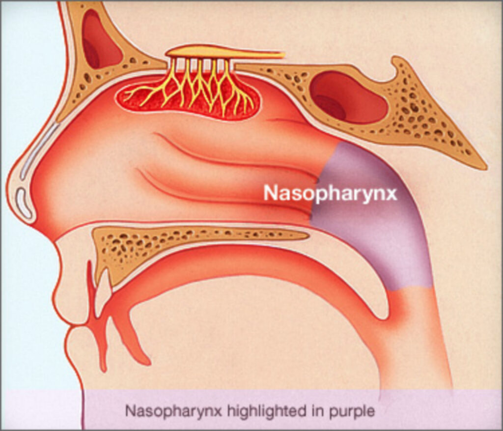 Ung thư mũi hầu (nasopharyngeal cancer – NPC)