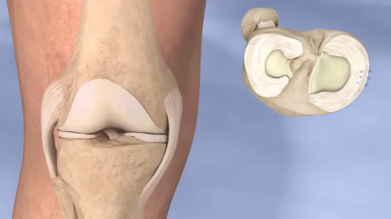 Vật lý trị liệu đóng vai trò quan trọng trong quá trình phục hồi chấn thương khớp gối