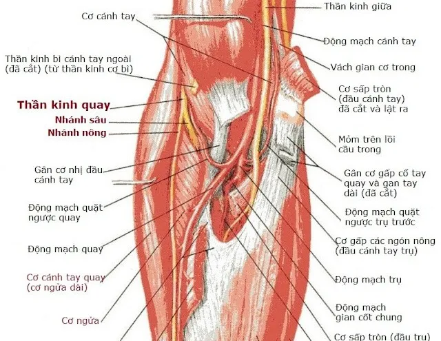 Hình minh họa bệnh lý thần kinh quay