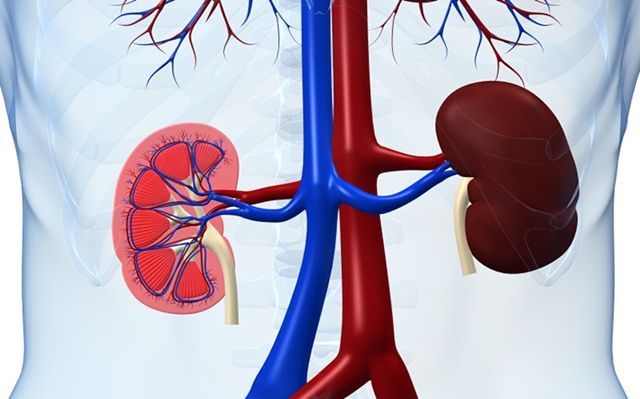 Hình minh họa siêu âm và chụp CT hỗ trợ chẩn đoán đài bể thận