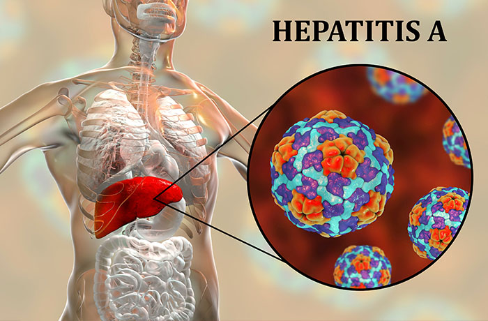 Hình mô phỏng cấu trúc virus viêm gan A HAV