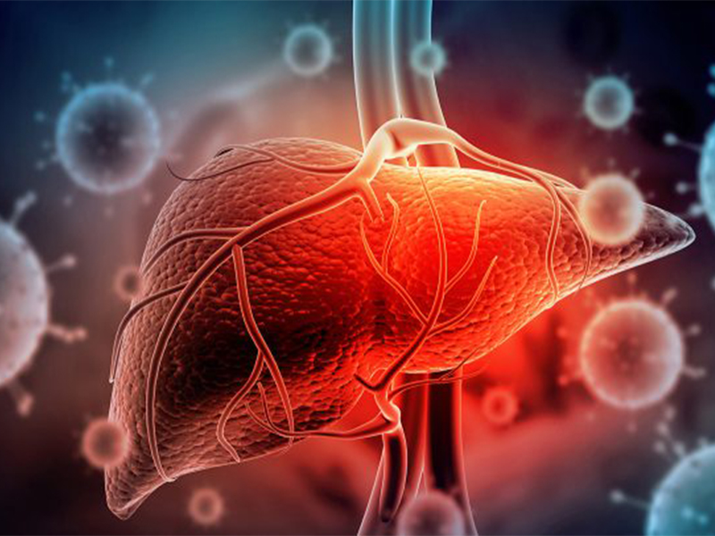 Viêm gan siêu vi A