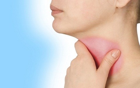 Viêm họng gây đau họng, niêm mạc họng đỏ