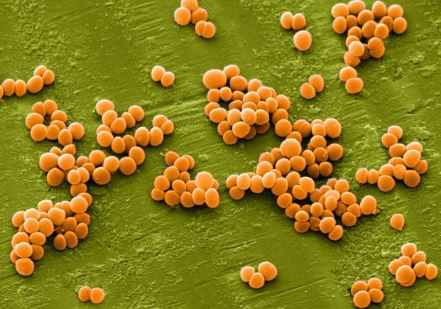 Staphylococcus aureus (Tụ cầu vàng) là nguyên nhân chính gây viêm khớp nhiễm trùng sinh mủ