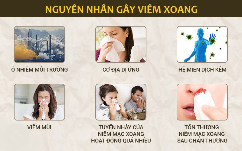 Nguyên nhân gây viêm xoang trán