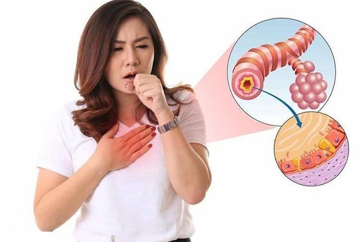 Hình ảnh cắt lớp vi tính giúp bác sĩ xác định chính xác phạm vi của các nốt xơ hóa trong phổi