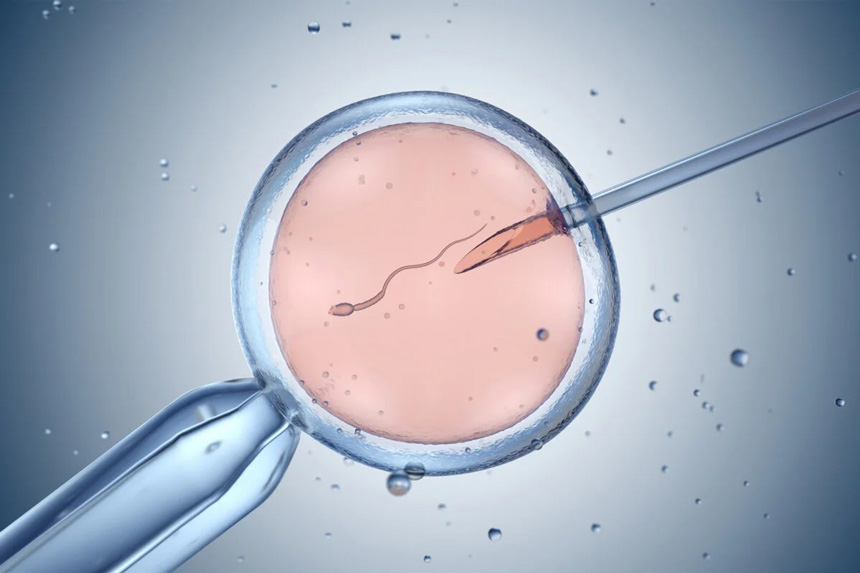 Thụ tinh trong ống nghiệm (IVF)