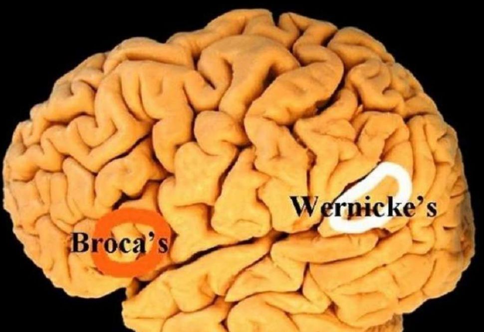 Hình ảnh bệnh não Wernicke