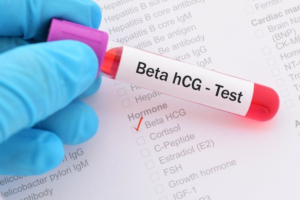 Minh hoạ về xét nghiệm nồng độ Beta-hCG
