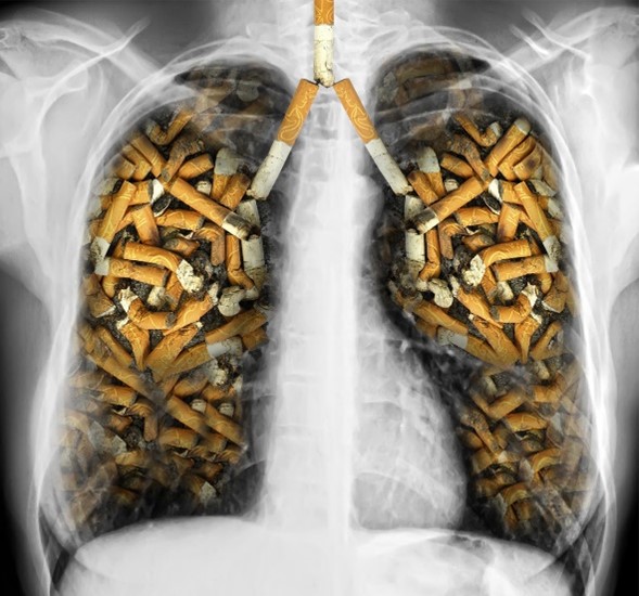 Hút thuốc lá là nguyên nhân hàng đầu gây ra các bệnh ở phổi