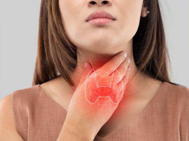 Cường giáp là một rối loạn chức năng nội tiết làm đẩy nhanh quá trình trao đổi chất 